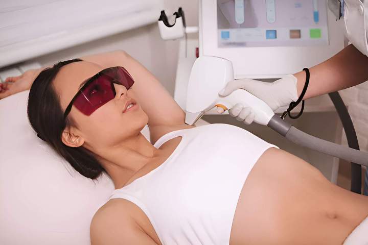 Underarm Laser Hair Removal Houston